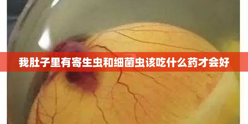 我肚子里有寄生虫和细菌虫该吃什么药才会好